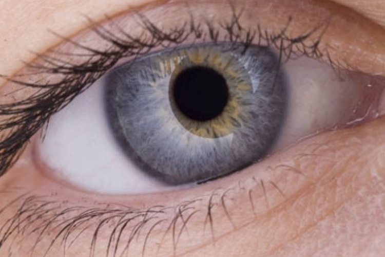 Génmutáció okozhatja a szem-melanomát 