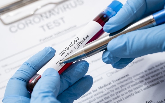 A Dombóvári Támasz Otthon gondozottjain és dolgozóin is végeztek koronavírus tesztet